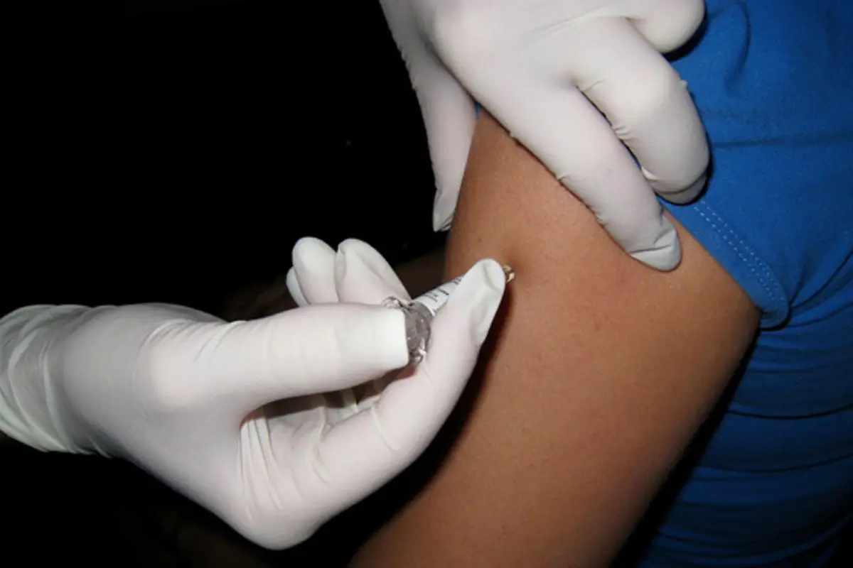 4 Hal yang Harus Kamu Ketahui dari Penyakit Hepatitis B