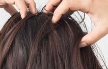 Cara Melebatkan Rambut: Panduan Lengkap untuk Rambut Tebal dan Sehat