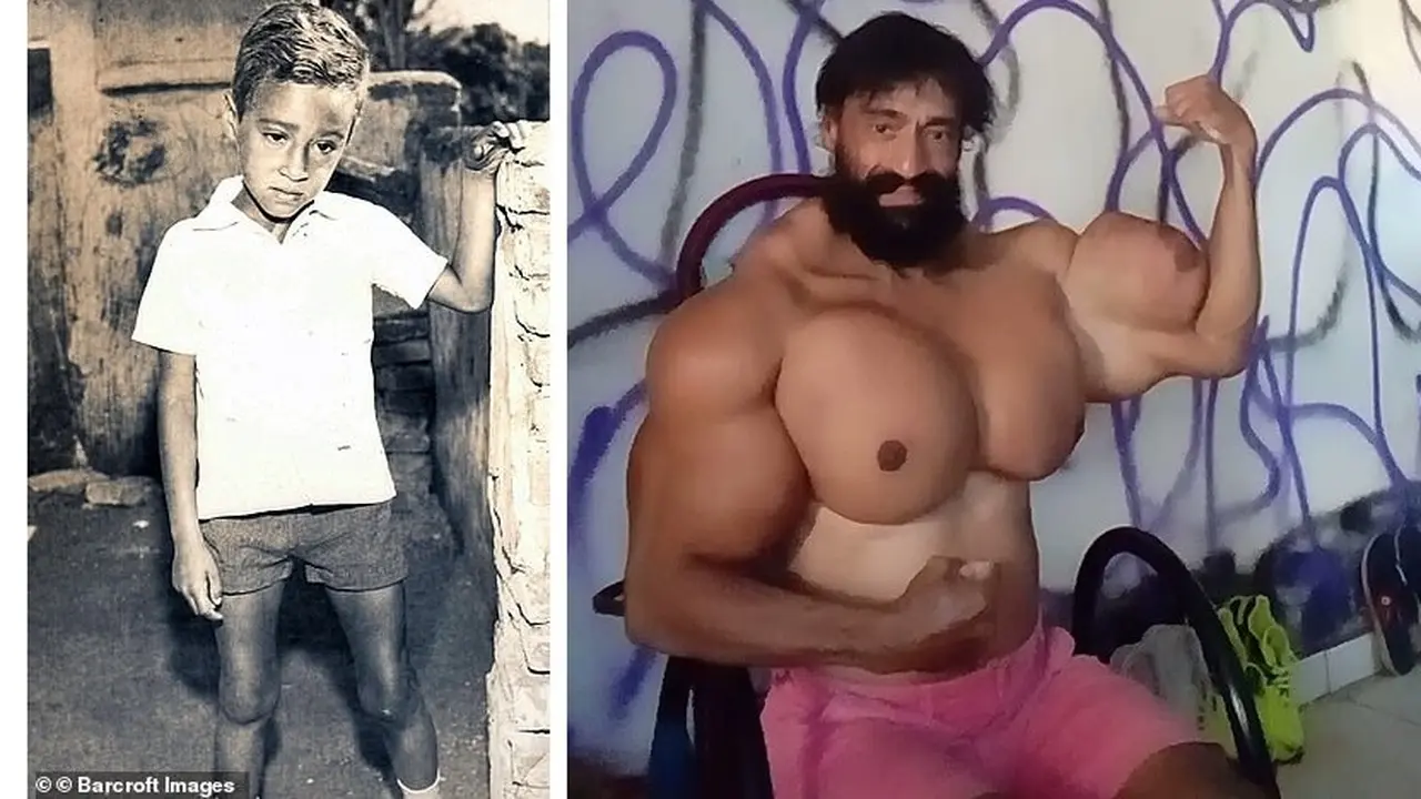Valdir Segato, suntik otot demi dapatkan badan kekar.