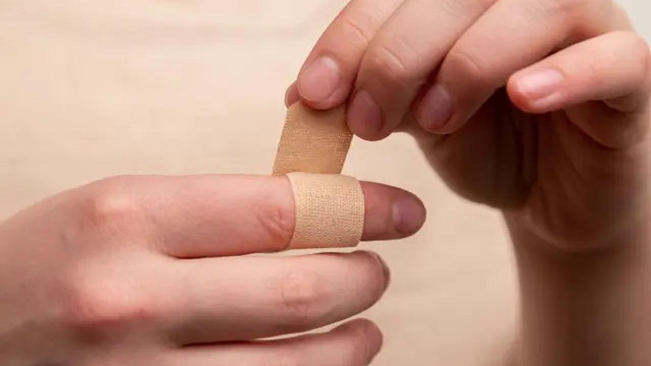Kenali Gejala Kolesterol Tinggi dari Tanda Tak Biasa di Tangan