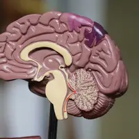 Banyak faktor yang menyebabkan kerusakan otak. Foto: Robina Weermeijer on Unsplash