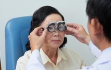 Dokter Mata Ungkap Fakta Mengerikan! Banyak Orang Abaikan Periksa Mata Rutin