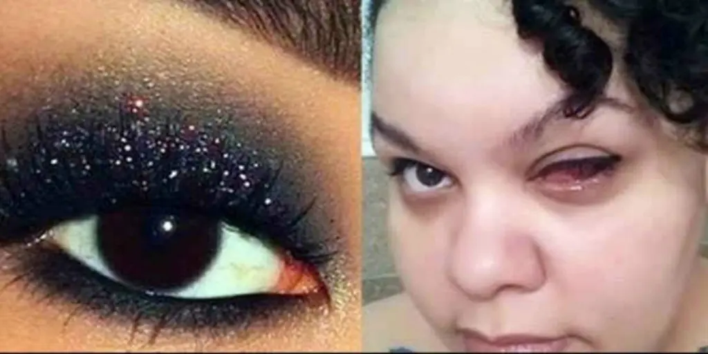 Setelah menggunakan makeup murah, hal mengerikan pun terjadi pada wanita ini. (Foto: Boldsky.com)