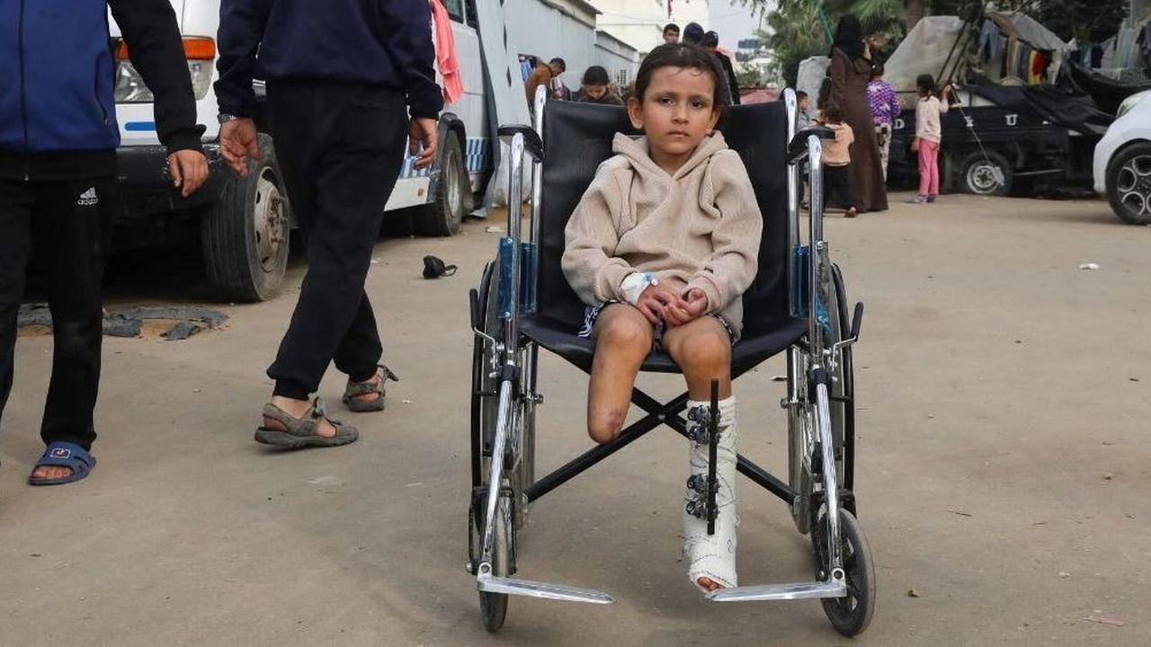 PBB: Setiap Hari Ada 10 Anak Gaza yang Satu atau Dua Kakinya Harus Diamputasi karena Serangan Israel
