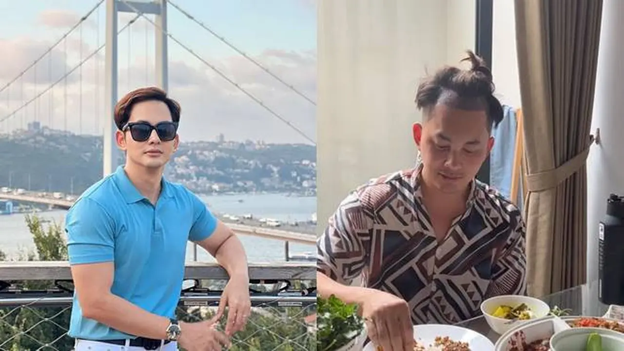 7 Potret Kiki Farel Transplantasi Rambut, Seru Nikmati Liburan Sebelum Operasi