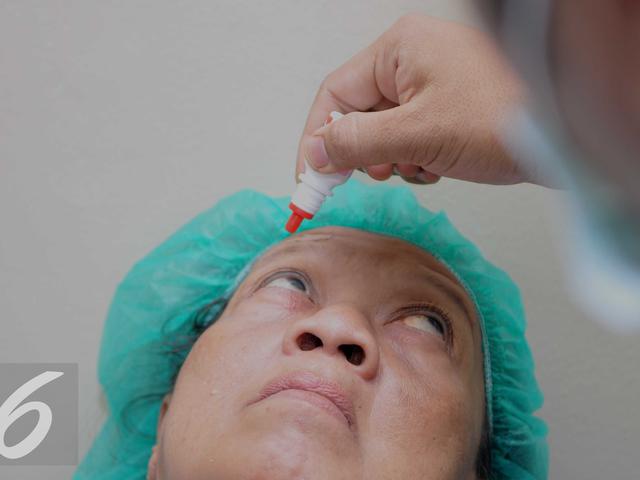 Bpjs Kesehatan Tegaskan Tanggung Pasien Katarak Dengan Standar Ini Health Liputan6 