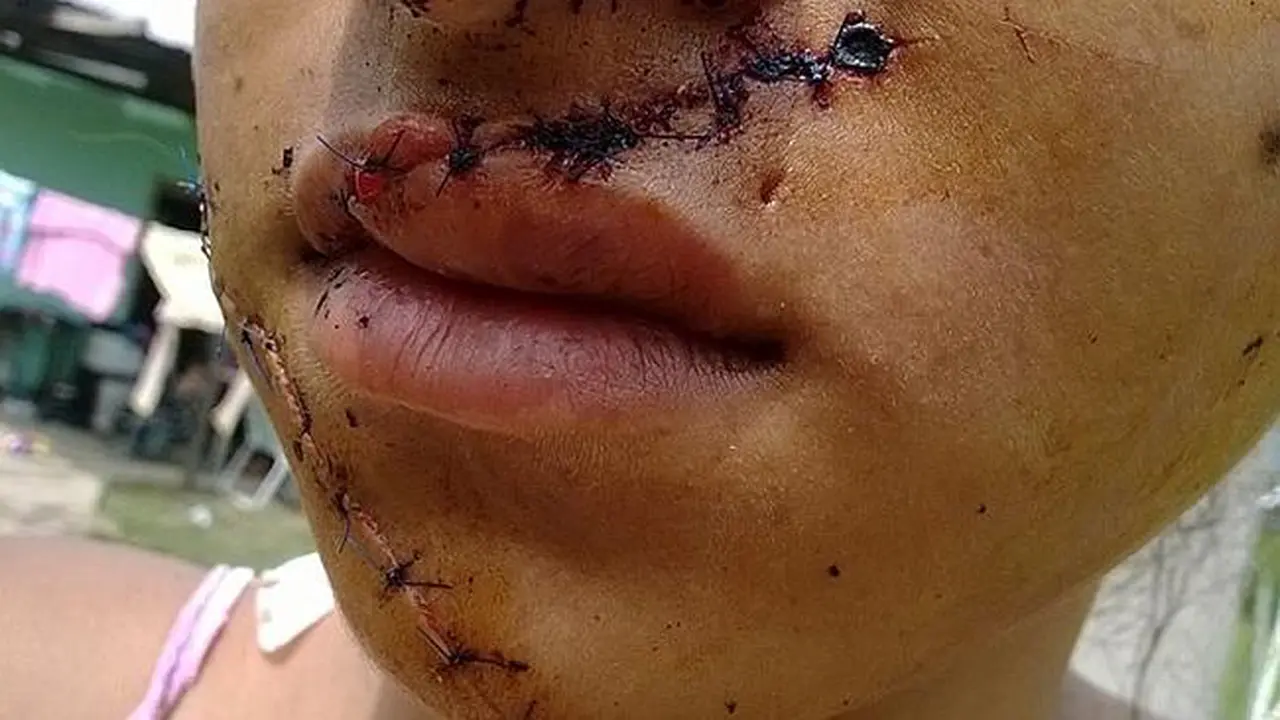 Karena Cantik, Gadis Dimutilasi Hingga Mirip Sosok Horor Chucky