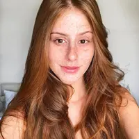 Wajah penuh dengan freckles.