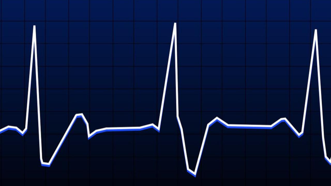 Apa Itu Resting Heart Rate? Kenali Standard yang Berbeda pada Setiap Orang
