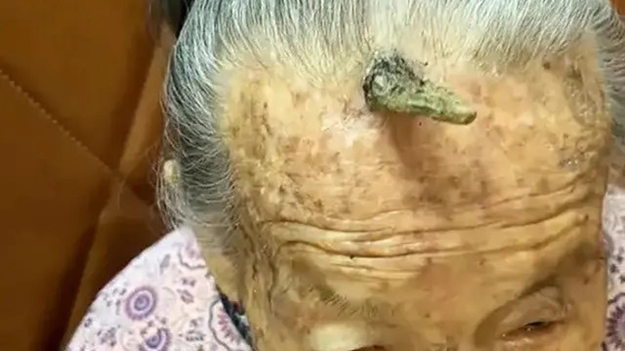 Viral Dahi Nenek 107 Tahun Ini Tumbuh Tanduk, Disebut Bikin Panjang Umur