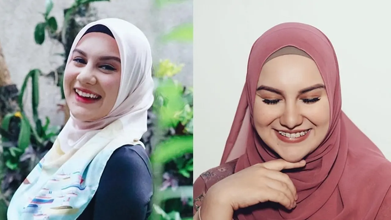 6 Potret Terbaru Irish Bella Tampil Pakai Behel, Ingin Hilangkan Gingsul