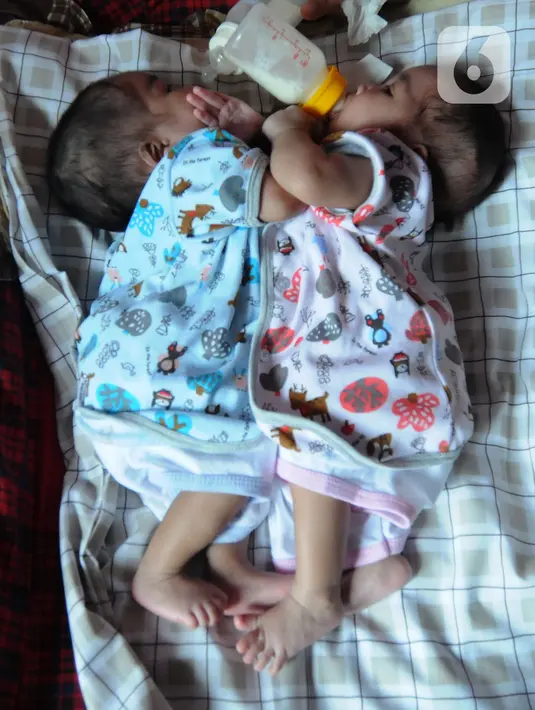 Bayi kembar siam Queenetha Zaina dan Queenesha Zahira di rumahnya di Perumahan Permata Indah Blok W No. 18 RT 18/03, Sukabumi, Sabtu (14/08/2021). Bayi kembar siam itu membutuhkan bantuan dana sebesar Rp1,6 milyar untuk operasi pemisahan di RS Hasan Sadikin Bandung. (merdeka.com/Arie Basuki)