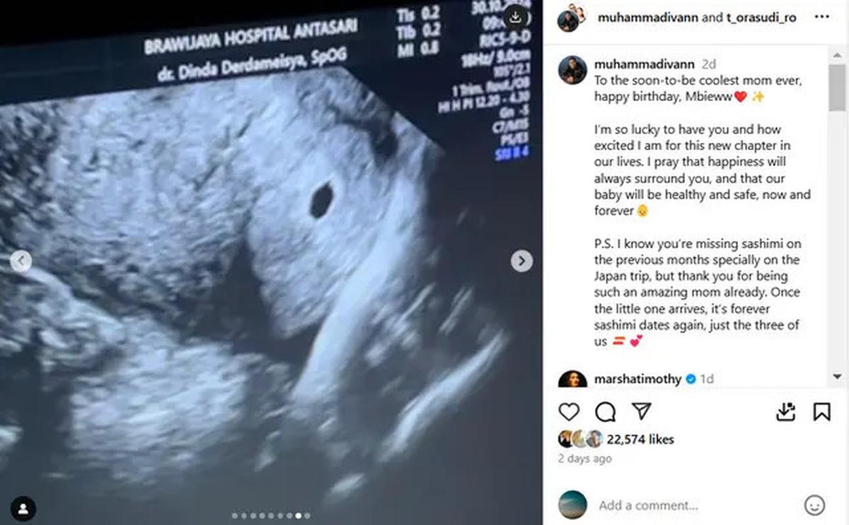 Putrinya Lagi Hamil, Tora Sudiro Bakal Jadi Kakek
