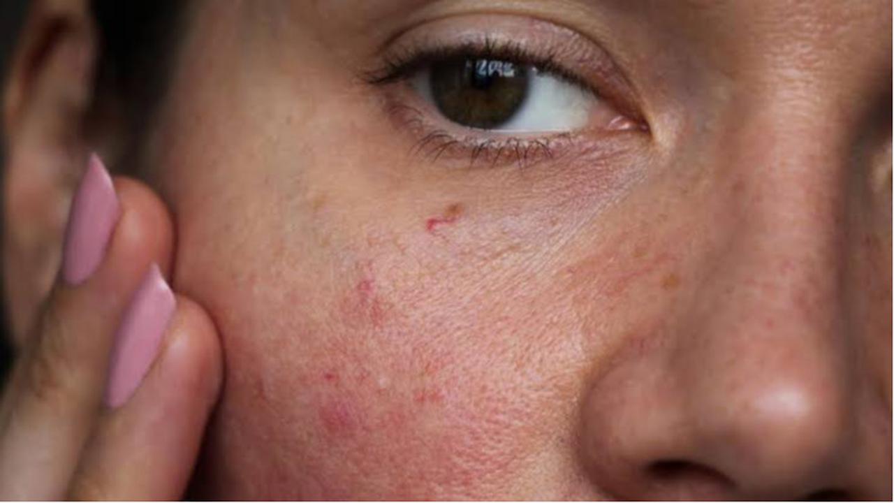 Retinol di Usia 20-an: Rahasia Kulit Mulus atau Overhype?