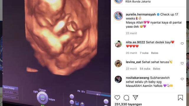 Unggahan Aurel Hermansyah. (Foto: Dok. Instagram @aurelie.hermansyah)