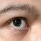 Ikuti Saran Internet Atasi Mata Berkedut, Pria Ini Alami Petaka