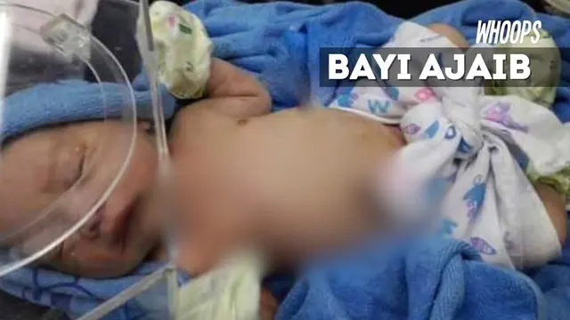 Dokter takjub melihat kondisi luka sang bayi yang cepat pulih.