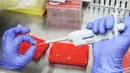 Doktor Tjandrawati Mozef Peneliti Biokimia Farmasi LIPI menguji alat deteksi alternatif virus corona di Laboratorium Kimia Lembaga Ilmu Pengetahuan Indonesia (LIPI) Puspiptek Serpong, Tangerang Selatan, Banten, Rabu (26/8/2020). (merdeka.com/Arie Basuki)