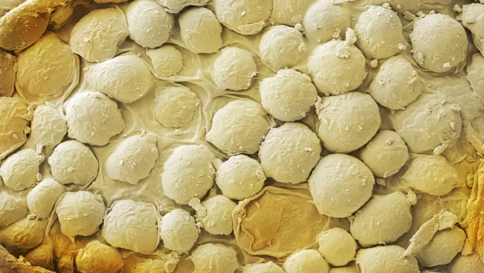 Difoto Pakai Mikroskop, Ini 10 Rupa Makanan yang Sesungguhnya!