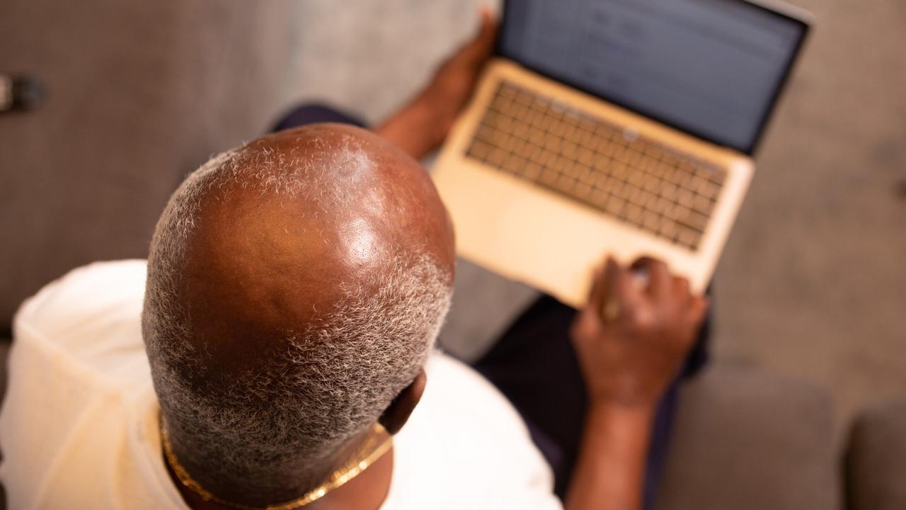 Ilustrasi pria botak. (dok. pexels/nappy)