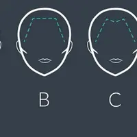 Begini arti kepribadian dari setiap bentuk garis batas rambut. (Sumber foto: