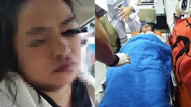 Seorang wanita tertancap pensil alis pada bagian mata.