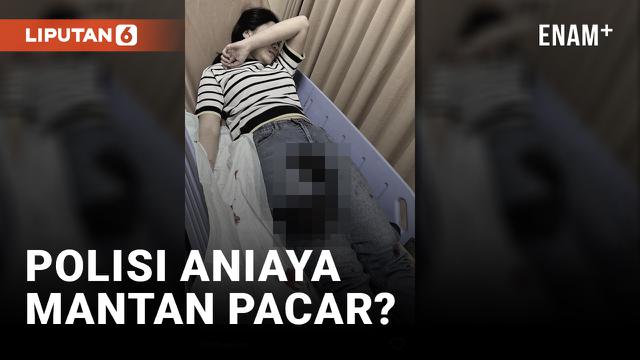 Oknum Polisi Disebut Aniaya Mantan Pacar Hingga Bersimbah Darah