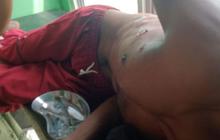 Cari Ikan di Aliran Sungai Air Hitam, Seorang Warga Luka Parah Digigit Buaya