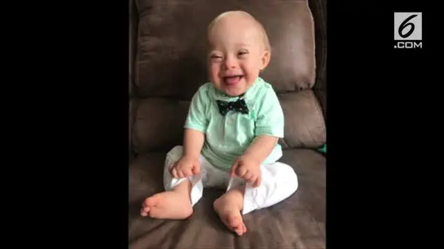VIDEO: Bayi Down Syndrome Menang Kontes "Baby Gerber 2018"