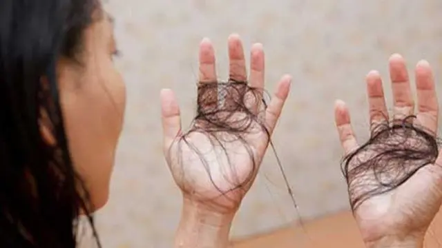 Rambut Rontok