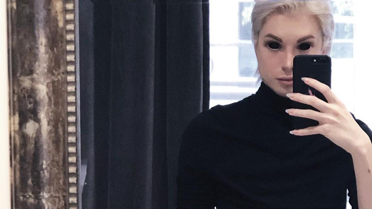 Pria Argentina Jalani 32 Operasi demi Mirip Peri