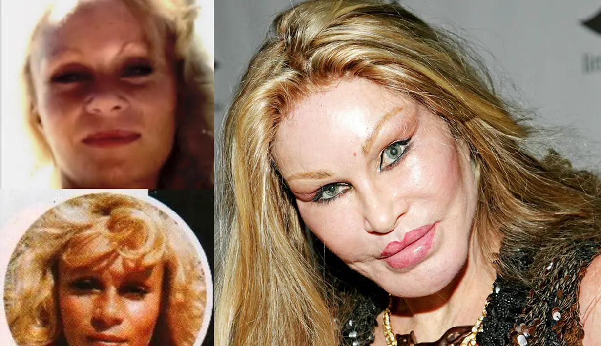 Jocelyn Wildenstein adalah sosialita New York yang terkenal karena berbagai oplas yang ia lakukan. Alih-alih menjadi tambah cantik, janda kaya raya ini justru lebih mirip monster (Istimewa)