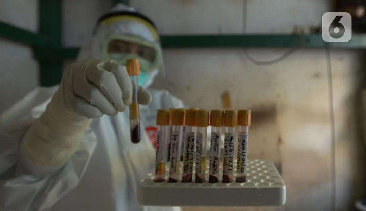 Petugas medis menunjukkan sampel Swab Test Covid-19 di pasar Perumnas Klender, Jakarta, Jumat (29/5/2020). Sebanyak, 50 pedagang pasar menjalani Rapid Test dan Swab Test untuk kedua kalinya yang mana sudah dilakukan sebelumnya ada hasil reaktif lima orang pedagang pasar. (merdeka.com/Imam Buhori)