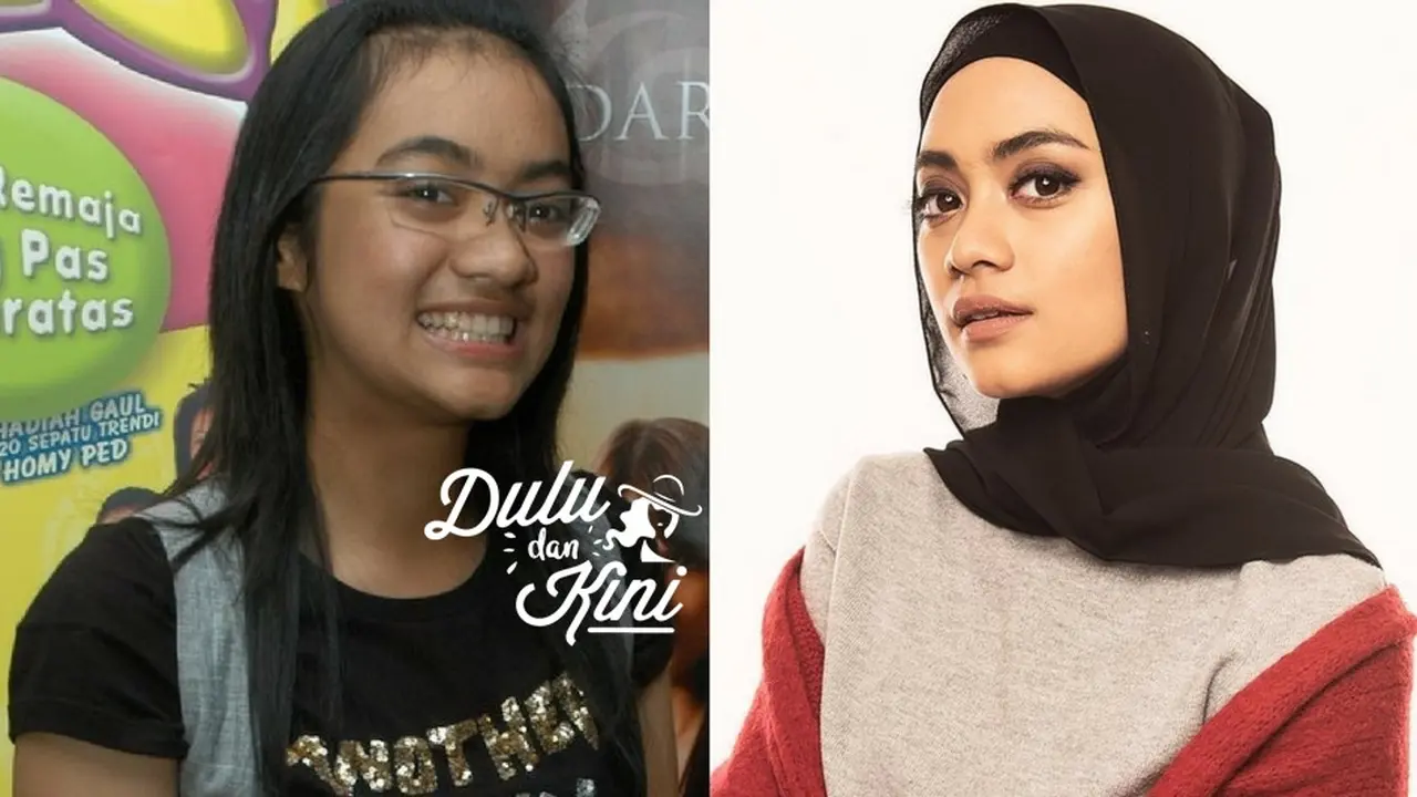 [Bintang] Dulu dan Kini: Masa Remaja Seperti Kutu Buku, Sekarang Ayudia Bing Slamet Cantik Berhijab