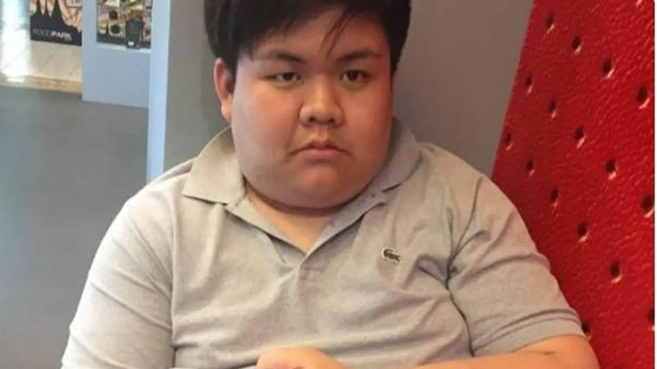 [Bintang] Obesitas