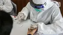 Petugas medis menunjukkan rapid test kepada penumpang KA jarak jauh di Stasiun Pasar Senen, Jakarta, Senin (27/7/2020).  PT KAI (Persero) mewajibkan penumpang untuk melakukan rapid test terlebih dahulu untuk menggunakan KA jarak jauh dengan tarif 85 ribu. (Liputan6.com/Faizal Fanani)