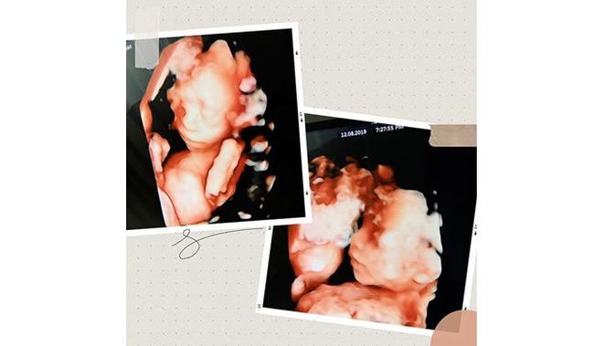 Bayi Kembarnya Meninggal, Ini 7 Potret Perjalanan Kehamilan Irish Bella (sumber: Instagram.com/_irishbella_)