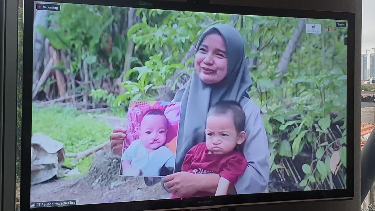 Kebahagiaan Seorang Ibu Melihat Senyum Sang Anak Usai Operasi Bibir Sumbing Gratis dari Sido Muncul