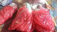 Cerita Bidan Kontrak di Desa Terpencil Flores Timur NTT Tangani Kelahiran Tiga Bayi Kembar 