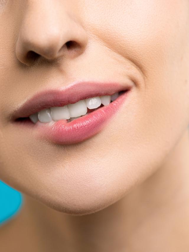 Ilustrasi gigi gingsul