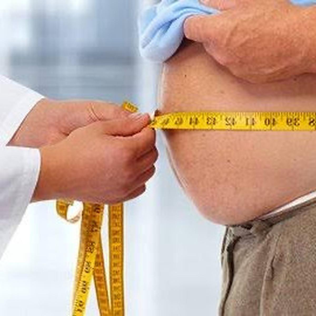 Operasi Bariatrik: Jalan Menuju Kehidupan Sehat bagi Penderita Obesitas Ekstrem