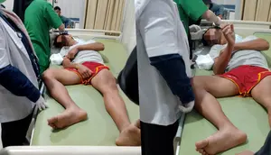 Atlet Tinju Jadi Korban Penganiayaan Brutal di Lampung