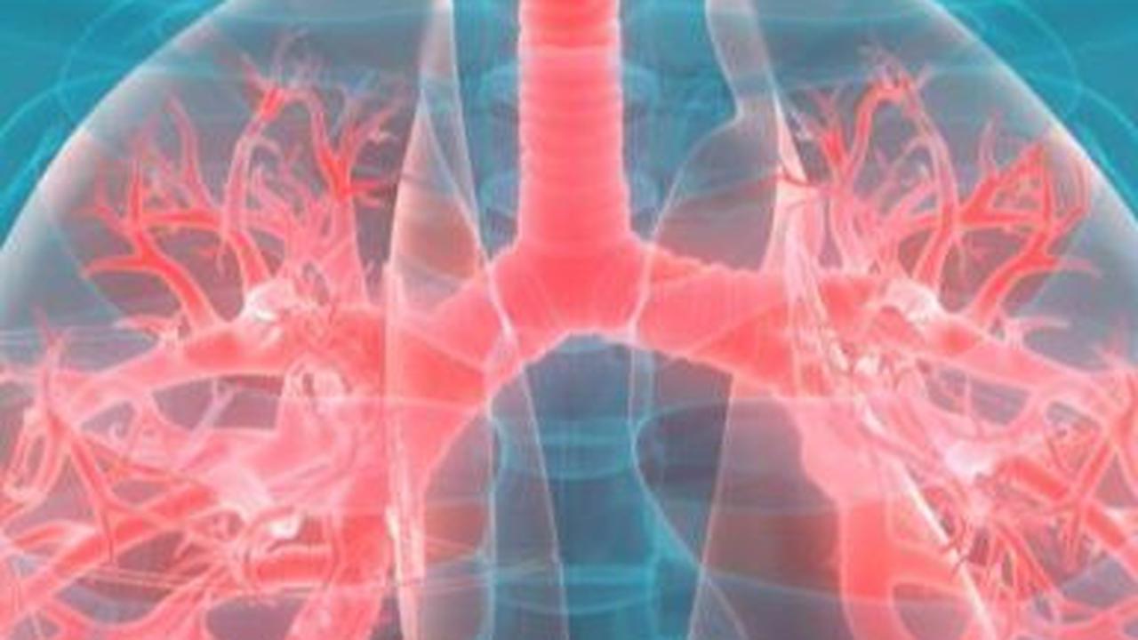 <b>Pneumonia</b>