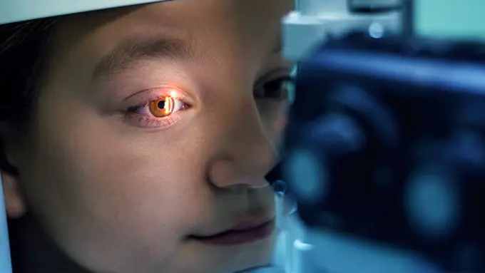 Ilustrasi Katarak (sumber: unsplash)