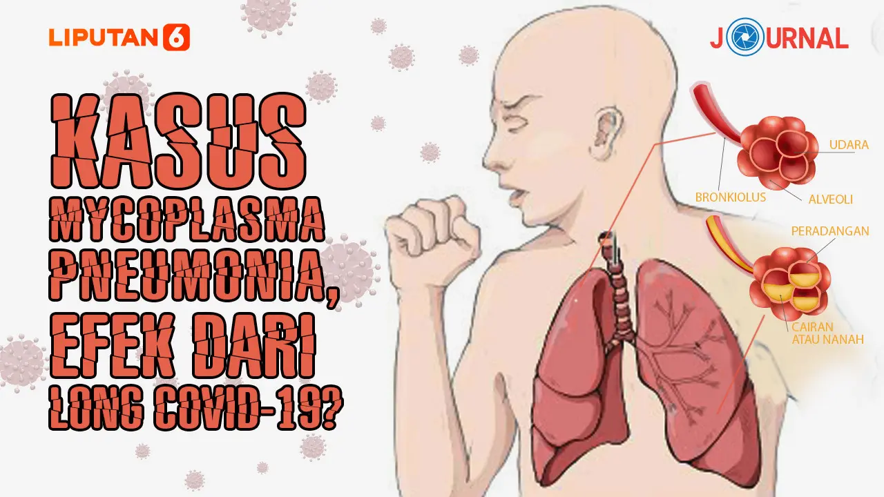 ilustrasi Kasus Mycoplasma Pneumonia, Efek dari Long Covid-19?