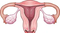 Gejala Kanker Endometrium yang Perlu Dikenali, Sempat Diidap Almarhumah Dina Mariana