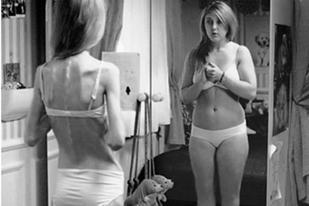 Selalu Nggak 'PD'? Jangan-jangan Kamu Terkena Dysmorphophobia