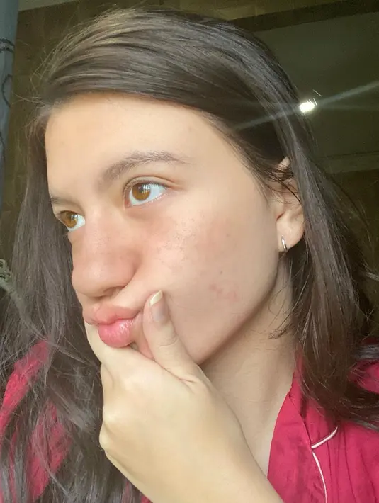 Ini dia foto Cassandra Lee saat tak menggunakan riasan sama sekali. Penampilannya satu ini juga cukup jadi sorotan netizen. (Liputan6.com/IG/@cassandraslee)