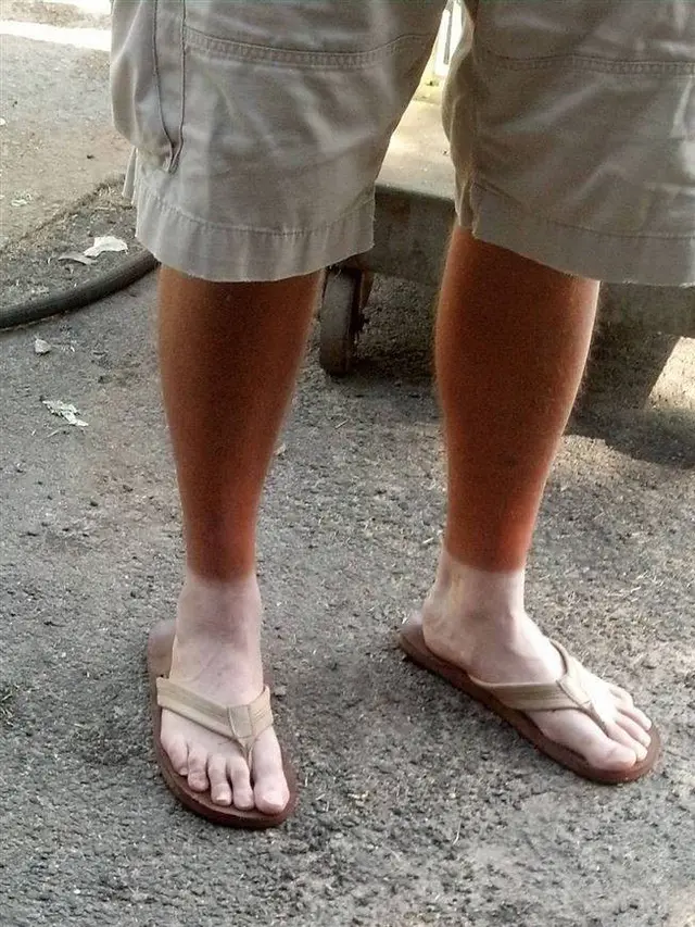 6 Potret Orang Belang di Kaki Karena Panas Ini Bikin Senyum