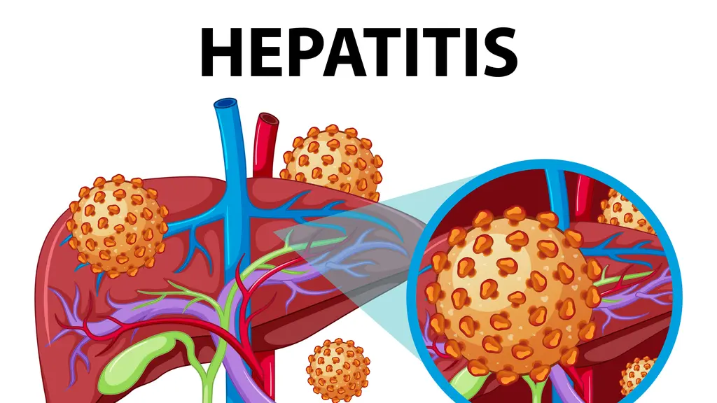 Penyakit Hepatitis dan jenis-jenisnya yang perlu diketahui. (foto: brgfx/freepik)